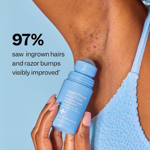 Smoothing Solution for Ingrown Hair